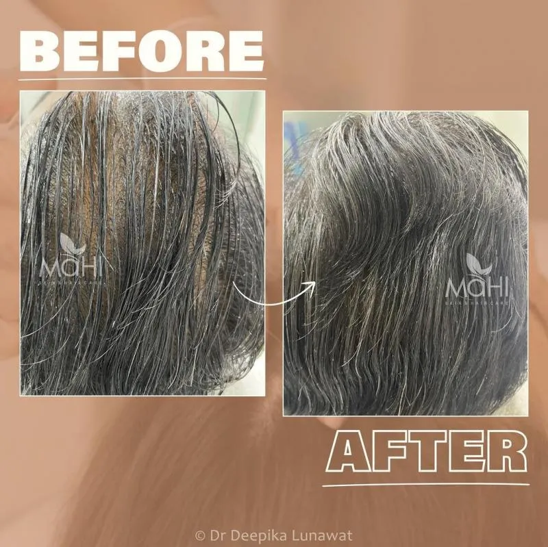 Business 5 image MAHI SKIN, HAIR & LASER CLINIC, KILPAUK