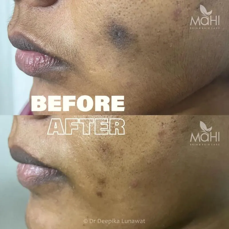 Business 1 image MAHI SKIN, HAIR & LASER CLINIC, KILPAUK