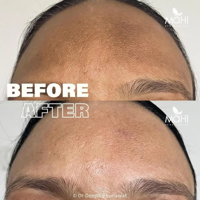 Business 4 image MAHI SKIN, HAIR & LASER CLINIC, KILPAUK