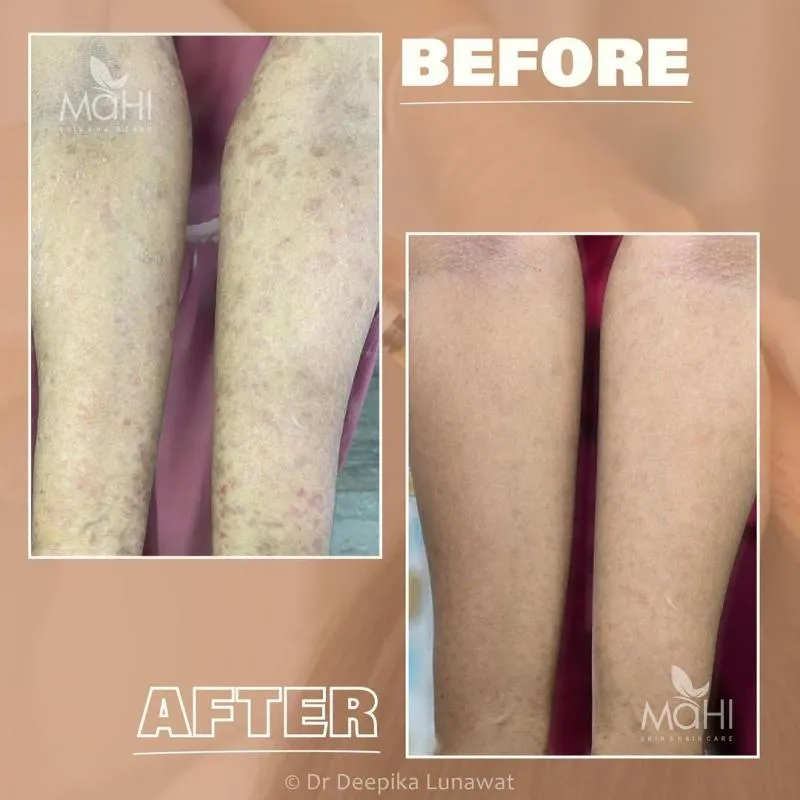 Business 6 image MAHI SKIN, HAIR & LASER CLINIC, KILPAUK